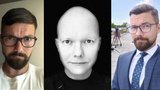 Exmoderátor ČT Drahoňovský k nepoznání: Alopecie mu vzala vlasy, vousy, obočí i řasy