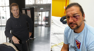 Bratr exmanažera Pešíra od nároďáku těžce zraněn: Zákeřný útok! Bratr exmanažera Pešíra od nároďáku těžce zraněn: Zákeřný útok!