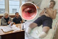 Zmrzačený Tomáš (20) u soudu hledá spravedlnost: Kruté následky neštovic! Přišel o nohy...