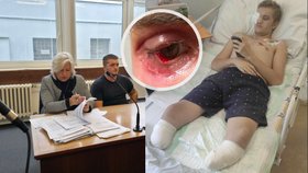 Zmrzačený Tomáš (20) u soudu hledá spravedlnost: Kruté následky neštovic! Přišel o nohy...