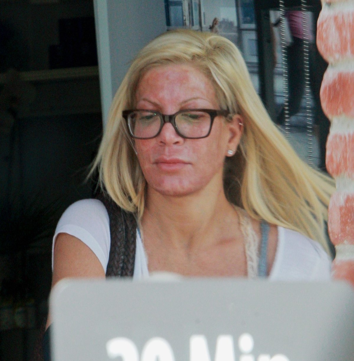 Tori Spelling se zarudlým obličejem. Herečka chodí pravidelně na chemický peeling.