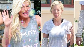 Tori Spelling si popálila ruku. Žaluje za to restauraci.