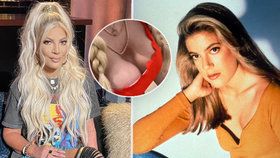 Donna z Beverly Hills přiznala prošlé implantáty: Nikdo mi neřekl, že je mám vyměnit!