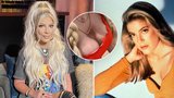 Donna z Beverly Hills přiznala prošlé implantáty: Nikdo mi neřekl, že je mám vyměnit!