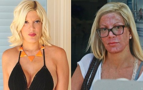 Pro Tori Spelling možná bude lepší už se zkrášlováním přestat...