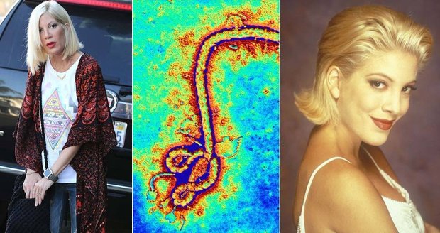 Ebola nakazila Hollywood? Herečka z Beverly Hills 90210 v karanténě!