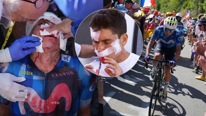 Krvavý konec na Tour, 20 stehů! Rubio vletěl obličejem do auta, které brzdilo před davy Krvavý konec na Tour, 20 stehů! Rubio vletěl obličejem do auta, které brzdilo před davy