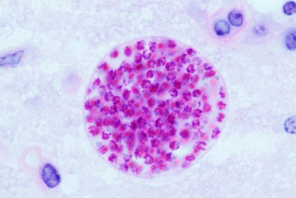 Toxoplazmóza