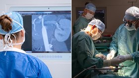 Covid zpomalil transplantace v Česku: Chybí personál i dárci, na čekatele se nedostává včas