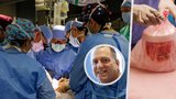 Velký pokrok transplantací: Prasečí ledvina vydržela Timovi 9 měsíců