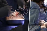 Další milník v medicíně prolomen: Nemocnice v USA oznámila první úspěšnou transplantaci prasečí ledviny člověku!