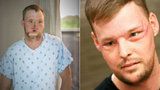 Pacient s dokonale transplantovanou tváří: Můj nový obličej? Učiněný zázrak!