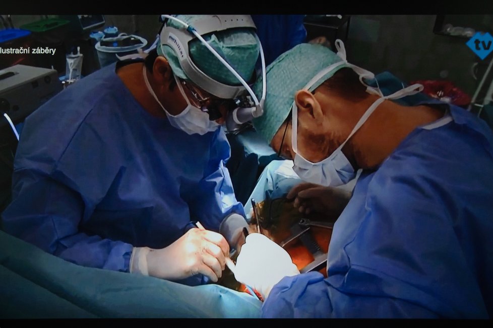 Transplantace plic se světovým rekordem v délce pobytu na mimotělní podpoře.