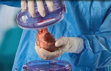 Srdce novorozenci! Unikátní transplantace v pražské nemocnici Motol