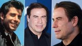 John Travolta s rohožkou na hlavě: Kam se poděly kadeře Dannyho z Pomády?