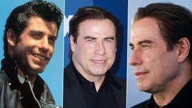 John Travolta s rohožkou na hlavě: Kam se poděly kadeře Dannyho z Pomády?