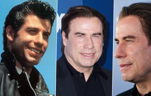 John Travolta s rohožkou na hlavě: Kam se poděly kadeře Dannyho z Pomády?