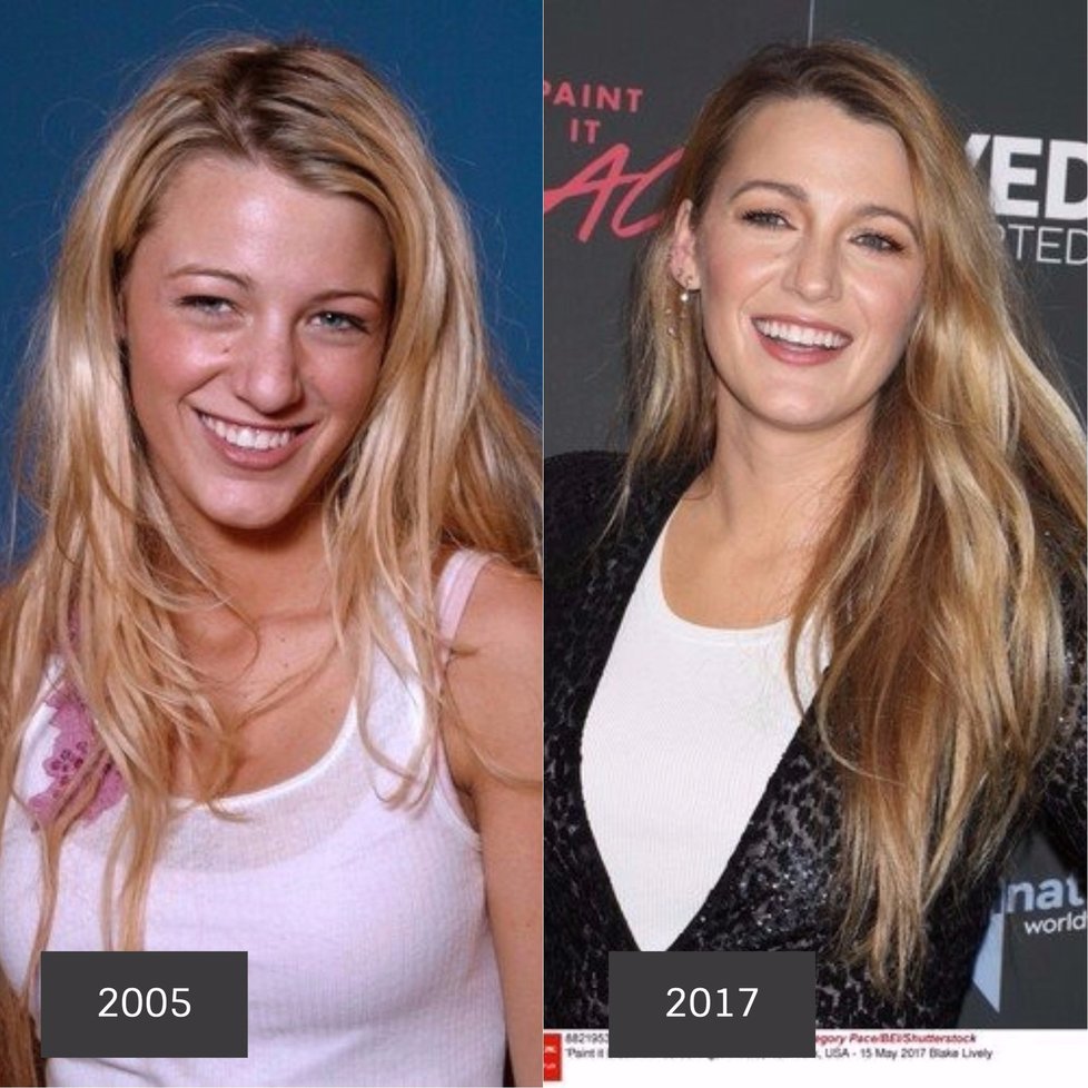 Herečka Blake Lively