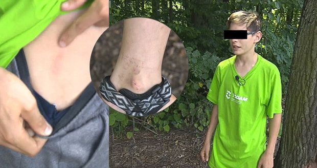 Chlapce v Třinci zasáhl blesk: Bliklo a pak jsem odletěl, popsal Jarda (14)