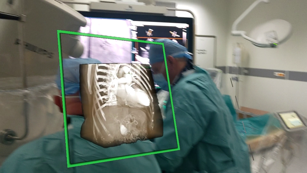 Do operací srdce s pomocí virtuální reality se pustili v Nemocnice AGEL Třinec-Podlesí na Frýdecko-Místecku.