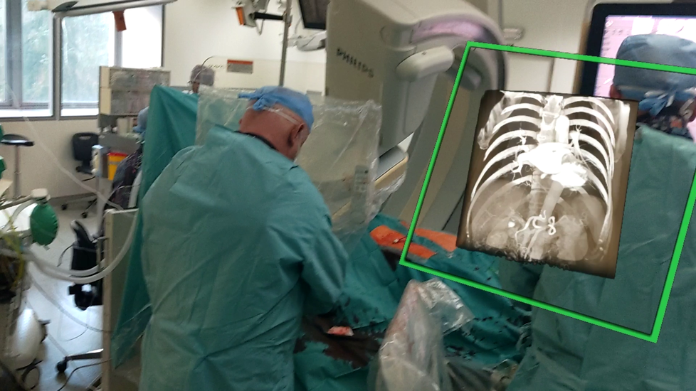 Do operací srdce s pomocí virtuální reality se pustili v Nemocnice AGEL Třinec-Podlesí na Frýdecko-Místecku.