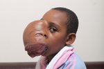 Trinny Amuhirwe (8) by si měla hrát s panenkami. Místo toho se ale připravuje na náročnou operaci