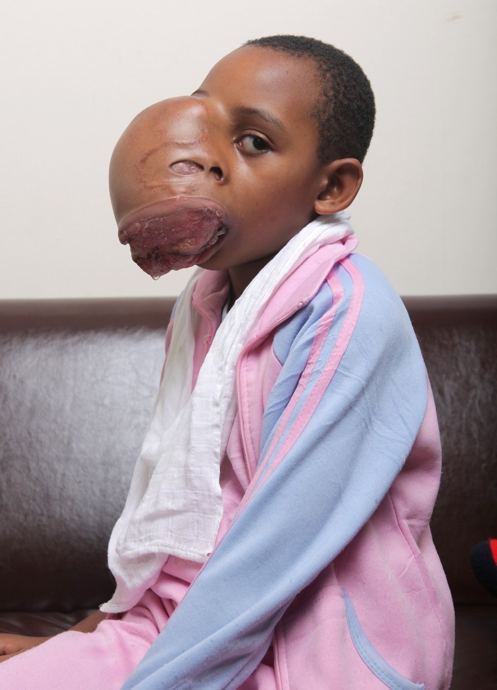 Trinny Amuhirwe (8) by si měla hrát s panenkami. Místo toho se ale připravuje na náročnou operaci