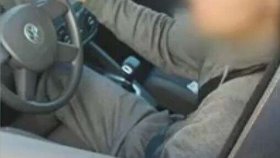 Rodiče přivezli batole s "horečkou" do nemocnice. Mělo podlitiny a zlomeniny.