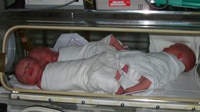 Trojčátka po narození v inkubátoru