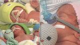 Zoe, Benedikt, Vincent: Maminka před porodem trojčátek ještě okopávala záhonky