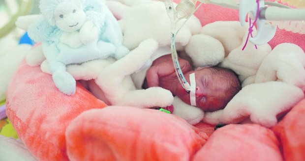 Amálka je  jednovaječné dvojče  Viktorky, vážila 560 g. Amálka je  jednovaječné dvojče  Viktorky, vážila 560 g.