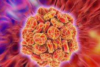 Časté a vážné onemocnění aneb Co byste měli vědět o žilní trombóze a embolii