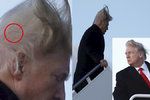 Vítr odhalil, dle předního amerického experta na transplantaci vlasů, jizvu na temeni prezidenta Donalda Trumpa.