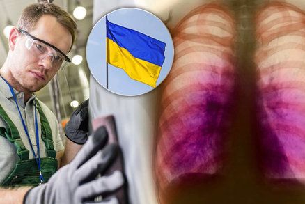 Cizinců s tuberkulózou přibývá: Do Česka ji přináší hlavně pracovníci z Ukrajiny