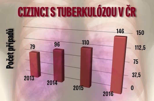 Počet cizinců s tuberkulózou v Česku každý rok roste.