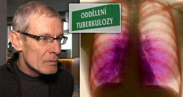 Vladimír (63) strávil dva měsíce v izolaci kvůli tuberkulóze. Lékaři: Česko je rarita