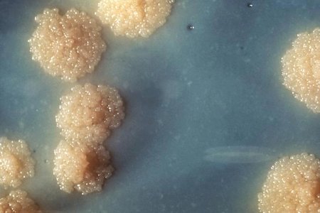Takto vypadá původce tuberkulózy bakterie mycobacterium tuberculosis pod mikroskopem.