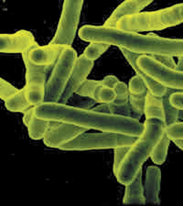 Tuberkulóza je vysoce infekční.