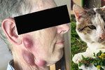 Vředy muži způsobila tularémie, kterou chytil od umírající kočky.