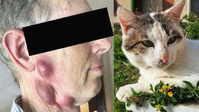 Muži se udělaly na obličeji obří vředy: Infekce od kočky!