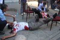 V turecké Ankaře vybuchla bomba: 3 mrtví a 15 zraněných