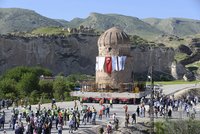 „Plešatá turistika“: Levná transplantace vlasů láká do Turecka