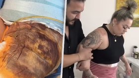 Britka se probudila během zpackané plastické operace. Tím problémy neskončily.