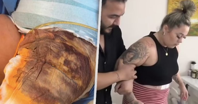 Britka se probudila během zpackané plastické operace. Tím problémy neskončily.