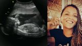 Je to zázrak: Moderátorka ČT Tvarůžková (38) čeká své první dítě