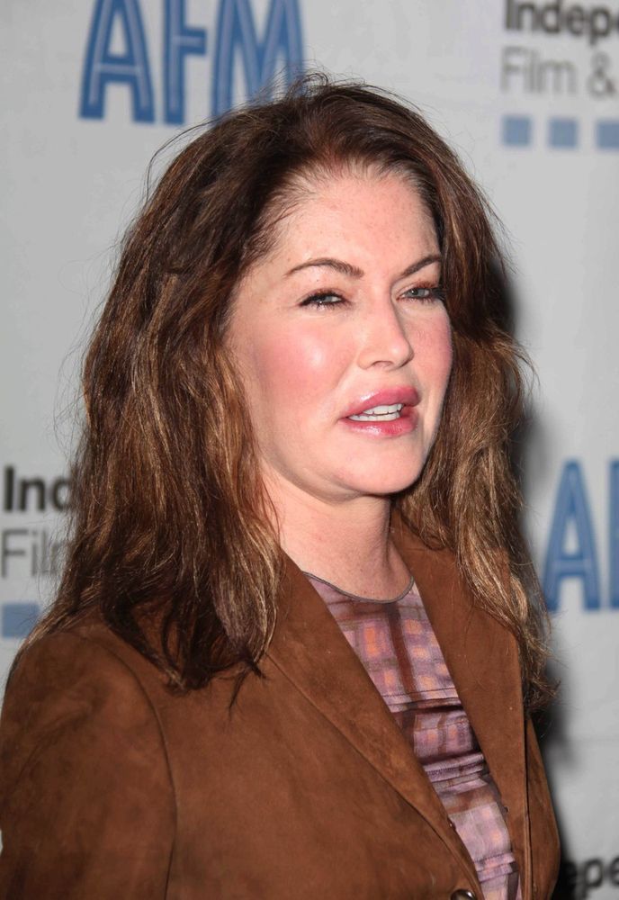 Lara Flynn Boyle to přehání s plastikami a je k nepoznání