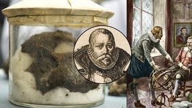 Astronom Brahe zemřel kvůli prostatě: Jedy z organismu se mu vrátily do krve a zabily ho.