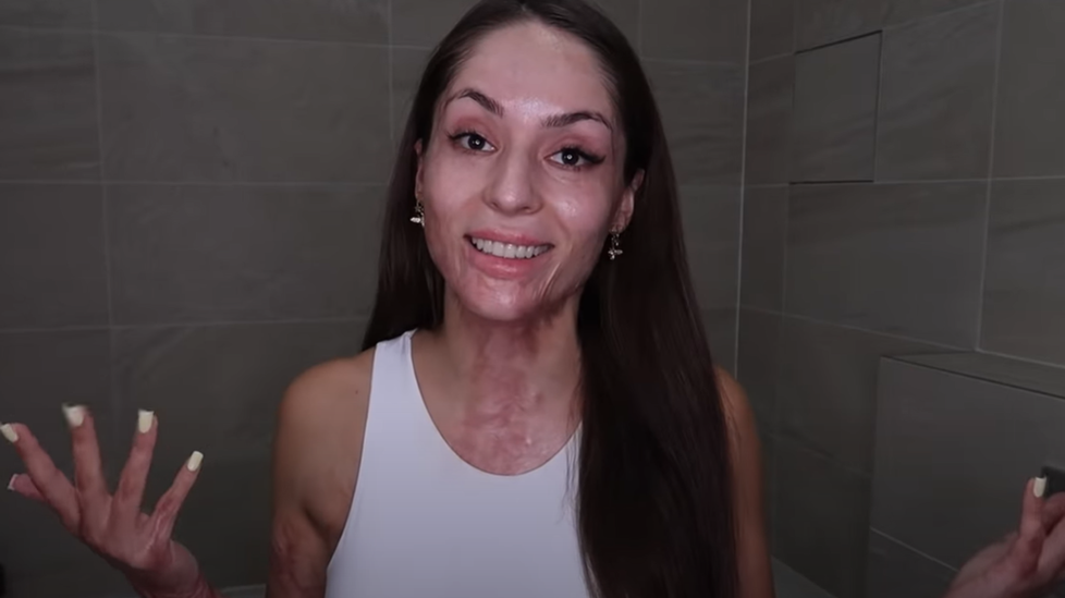 Odvážná Týnuš Třešničková se ukázala bez makeupu