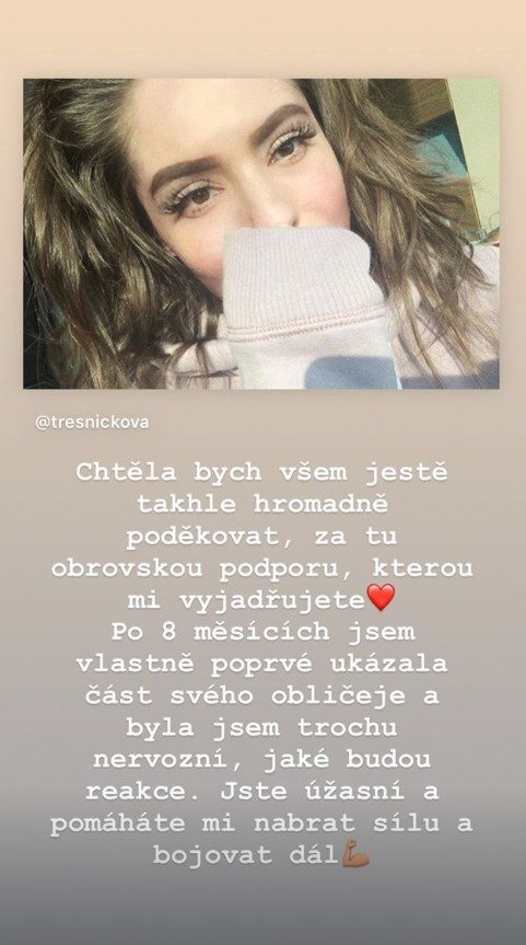 Blogerka Týnuš Třešničková přiznala na instagramu nervy, když se rozhodla odhalit obličej.