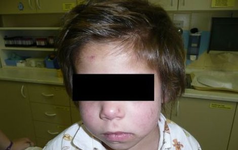 Týraný chlapec (ilustrační foto)